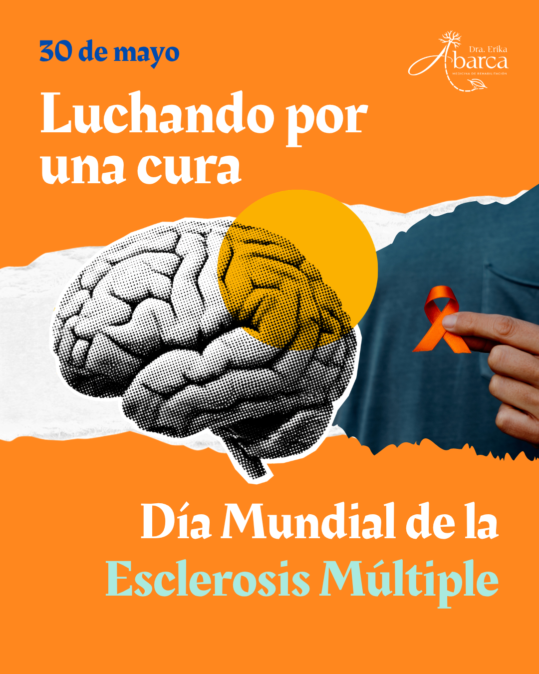 Más información sobre Esclerosis Múltiple